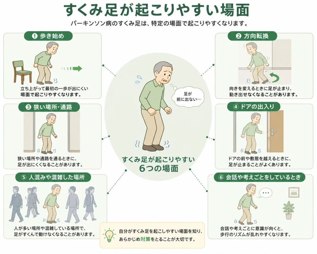 パーキンソン病のすくみ足が起こりやすい場面