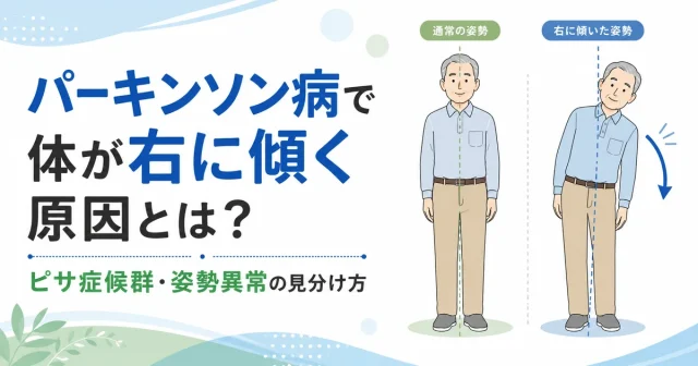 パーキンソン病で体が右に傾く原因とは