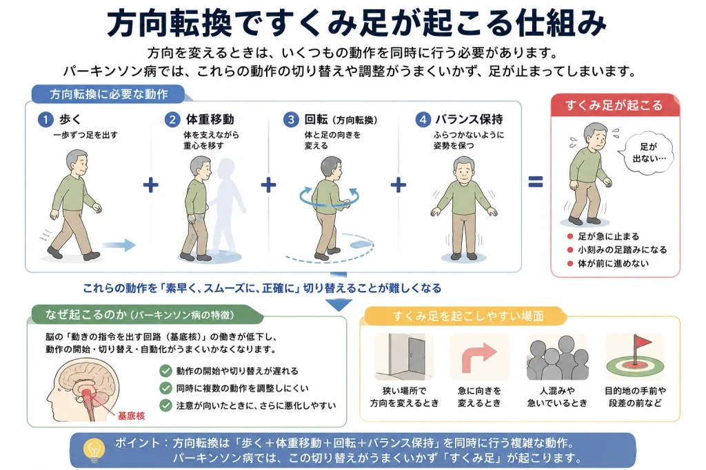 方向転換ですくみ足が起こる仕組み