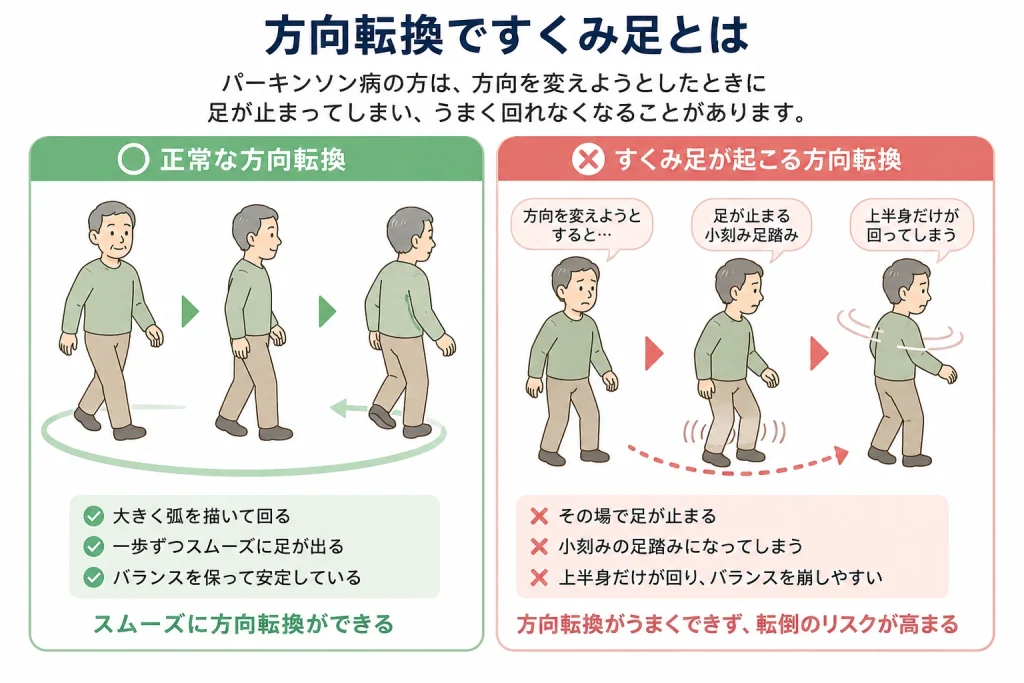 方向転換ですくみ足が起こる原因とは