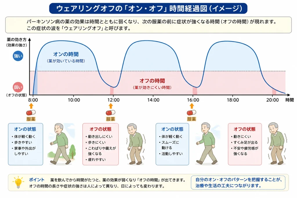 ウェアリングオフのオンオフ時間経過