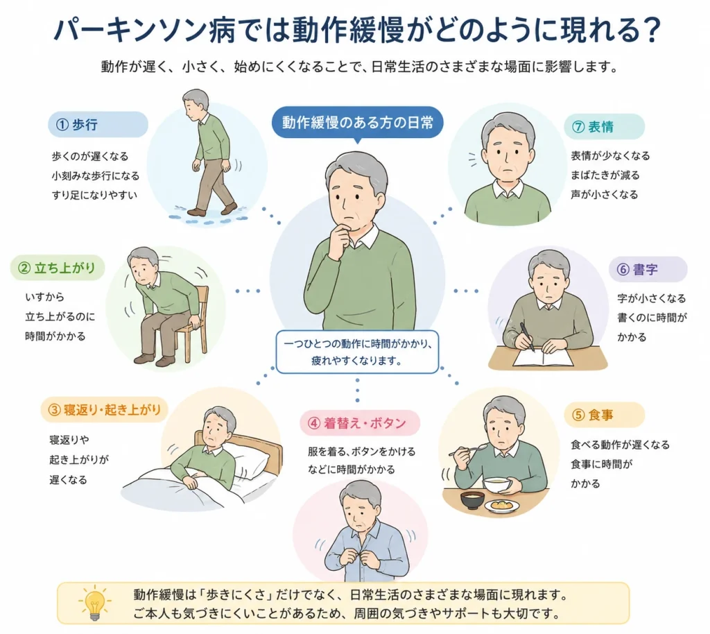 パーキンソン病では動作緩慢がどのように現れる？