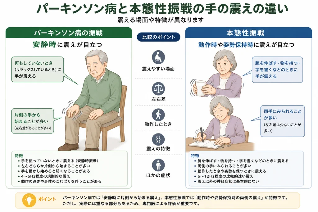 パーキンソン病と本態性振戦の違い