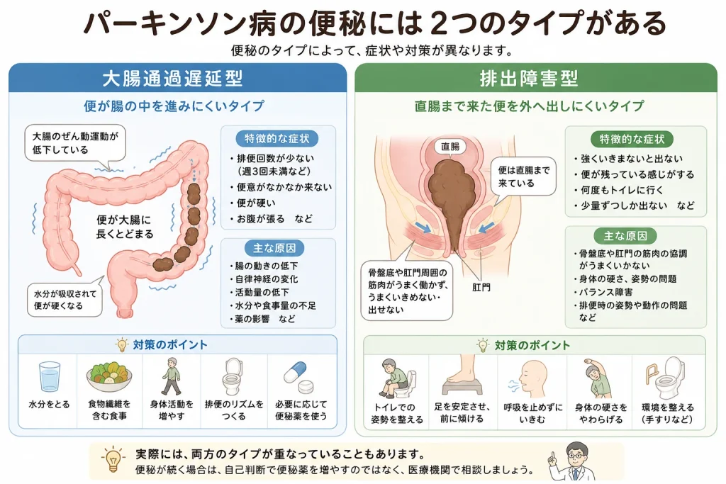 パーキンソン病の便秘には2つのタイプがある