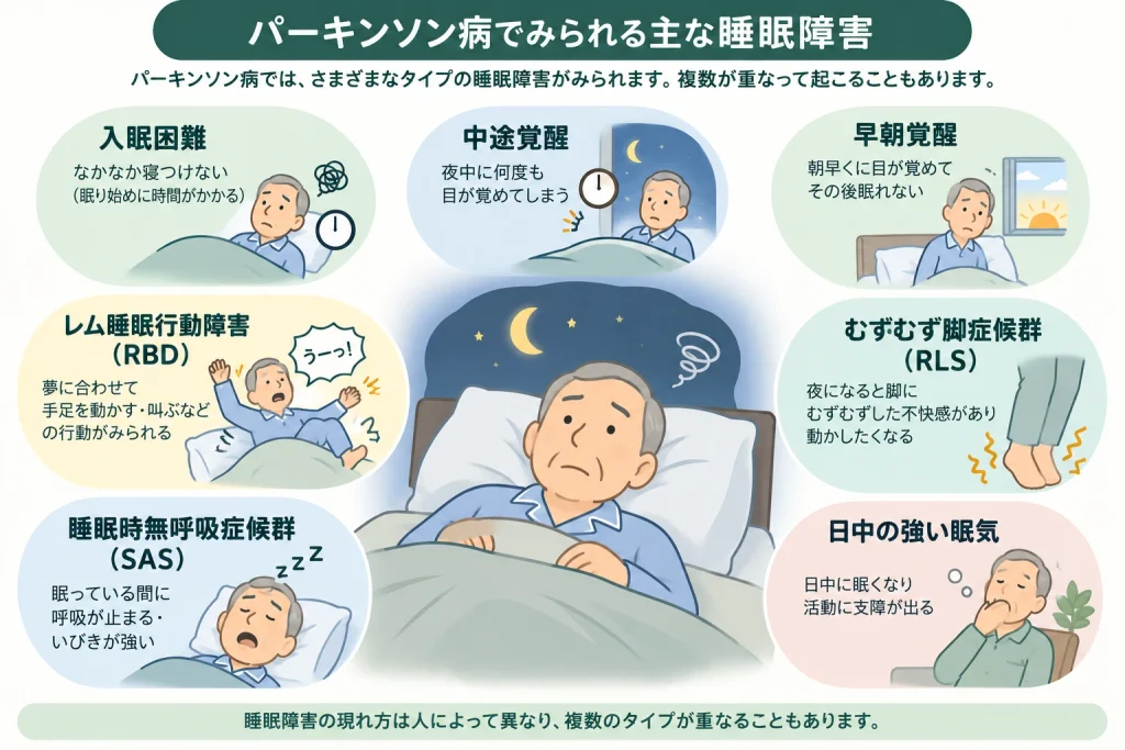 パーキンソン病でみられる主な睡眠障害