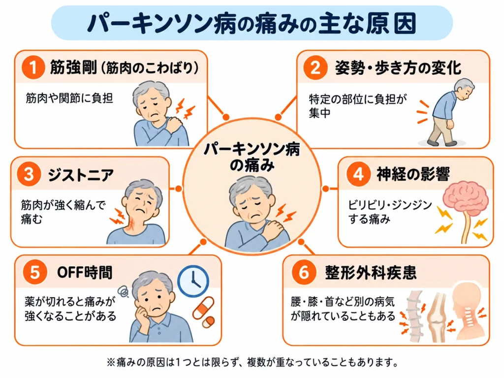 パーキンソン病の痛みの主な原因