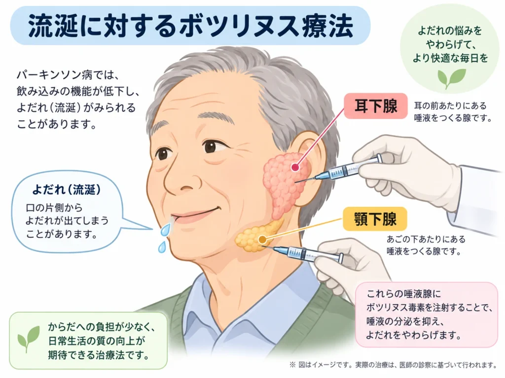 流涎に対するボツリヌス療法