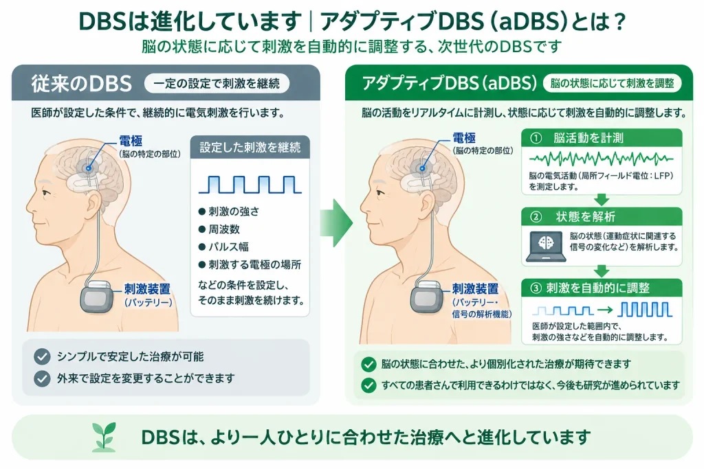 脳深部刺激療法（DBSとaDBSの比較)